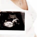 La banalización de la vida del “nasciturus”